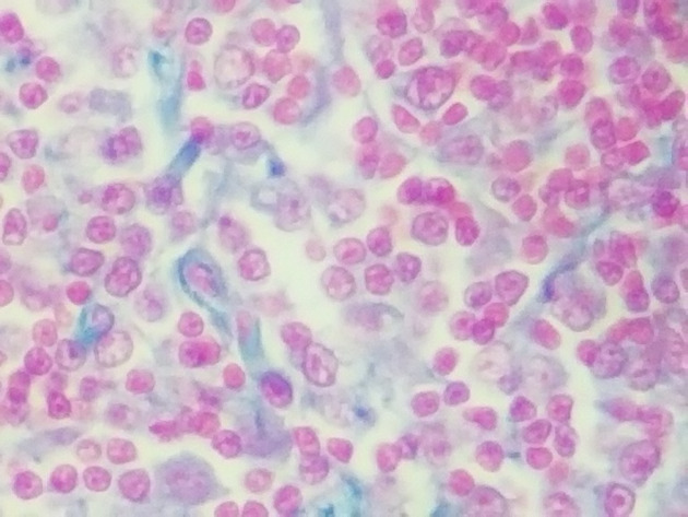 Reticular Connective Slides - Reticular Connective 10 400X